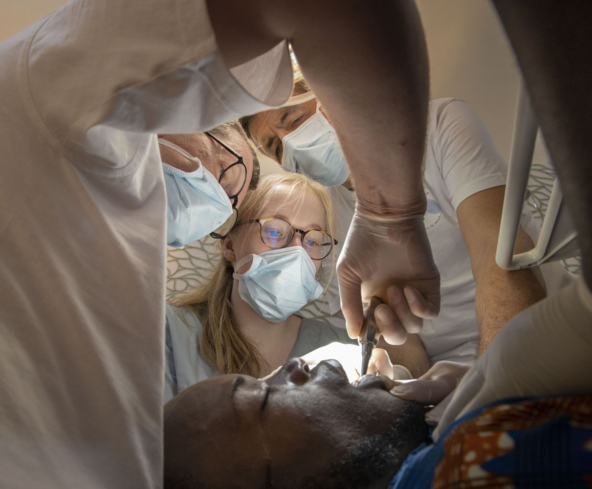Healthcare Fotografie: ein deutsches Zahnarzt-Team unternimmt eine komplizierte Zahnextraktion in einem afrikanischen Krankenhaus. Der Patient ist sediert. Nahaufnahme des Patienten.